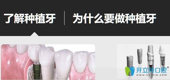 種植牙多少錢一顆