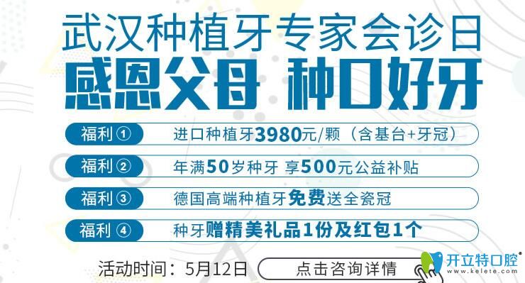 五一清華陽光口腔的種植牙價格也很讓人心動