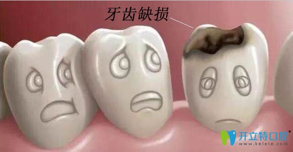 牙齒缺損修復(fù)方法哪種比較好?樂山英美口腔給出答案