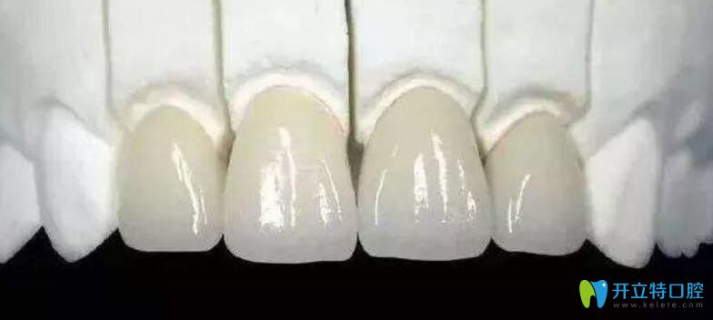 門牙做了烤瓷牙還能矯正嗎？聽濟南品潔口腔醫(yī)生解析