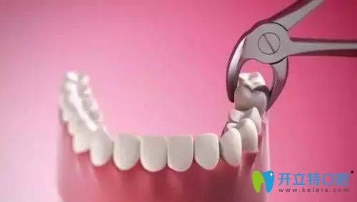 不拔牙矯正效果好不好?連江縣明輝口腔院長(zhǎng)是這樣說的.....