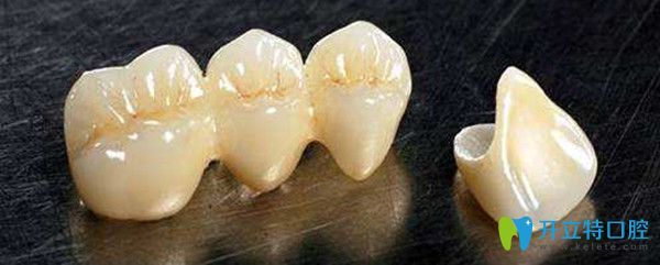 單冠和連冠的區(qū)別