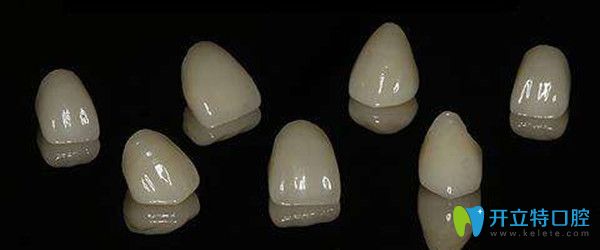 全瓷牙的優(yōu)勢