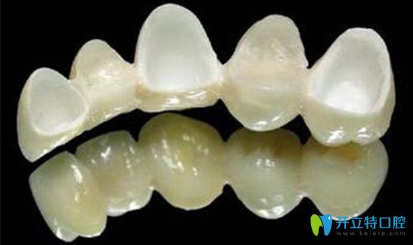 選擇單冠或連冠需聽取醫(yī)生建議