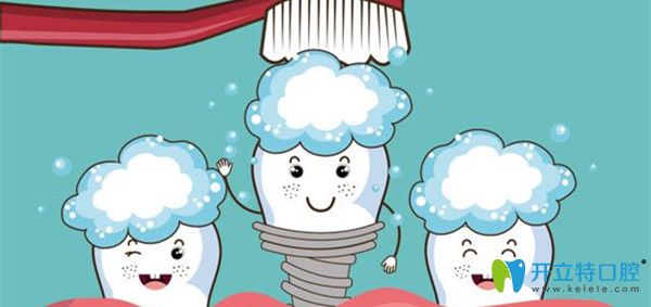 種植牙后要重視口腔衛(wèi)生的維護