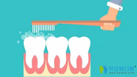 做了窩溝封閉后還要涂氟嗎