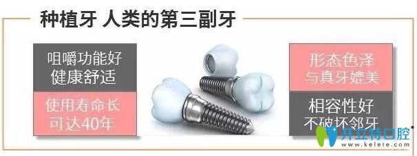 種植牙成功率有多高?具備以下條件可以提高種植牙的成功率