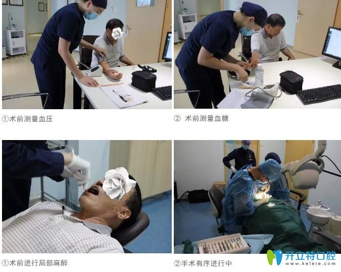 東莞好佰年口腔種植術(shù)前檢查