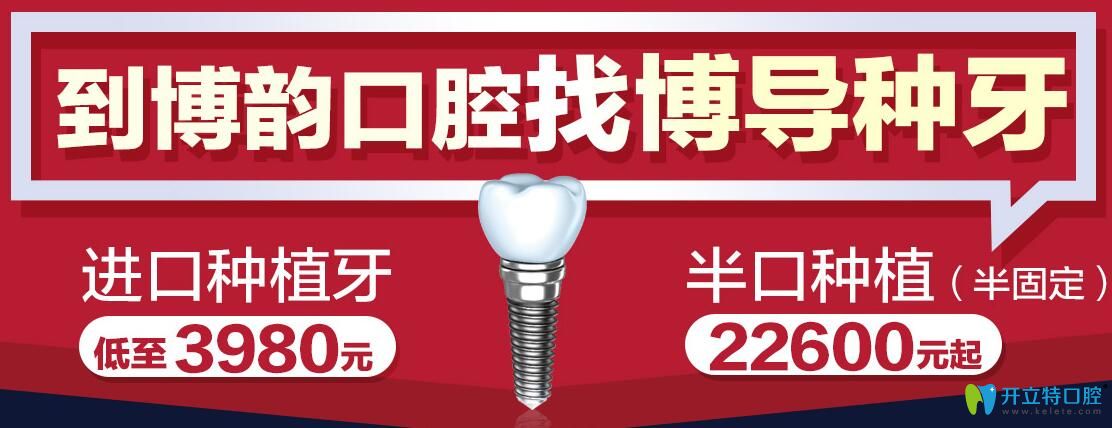 南京博韻口腔找博導(dǎo)種牙，半口種植（半固定）才49800元起
