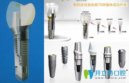 韓國奧齒泰種植牙種植體