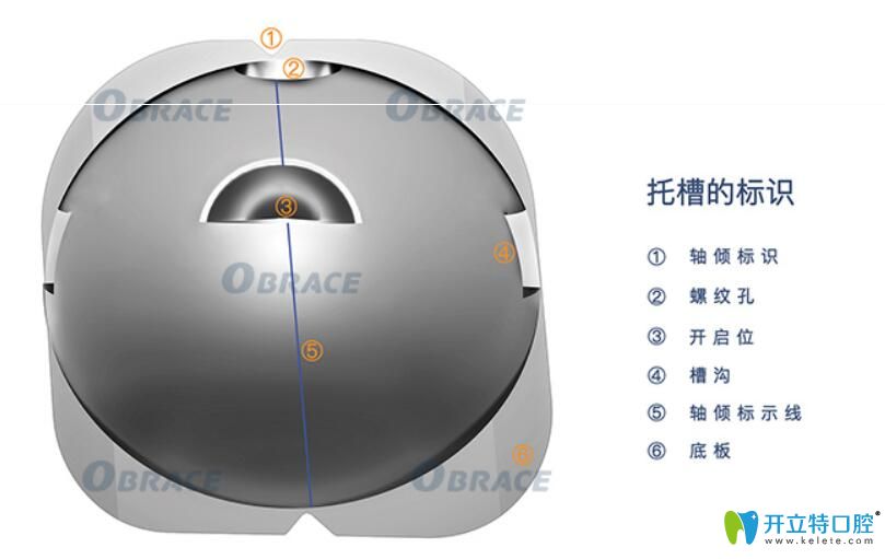 為什么要選擇obrace球面自鎖托槽矯正牙齒？答案在這里……