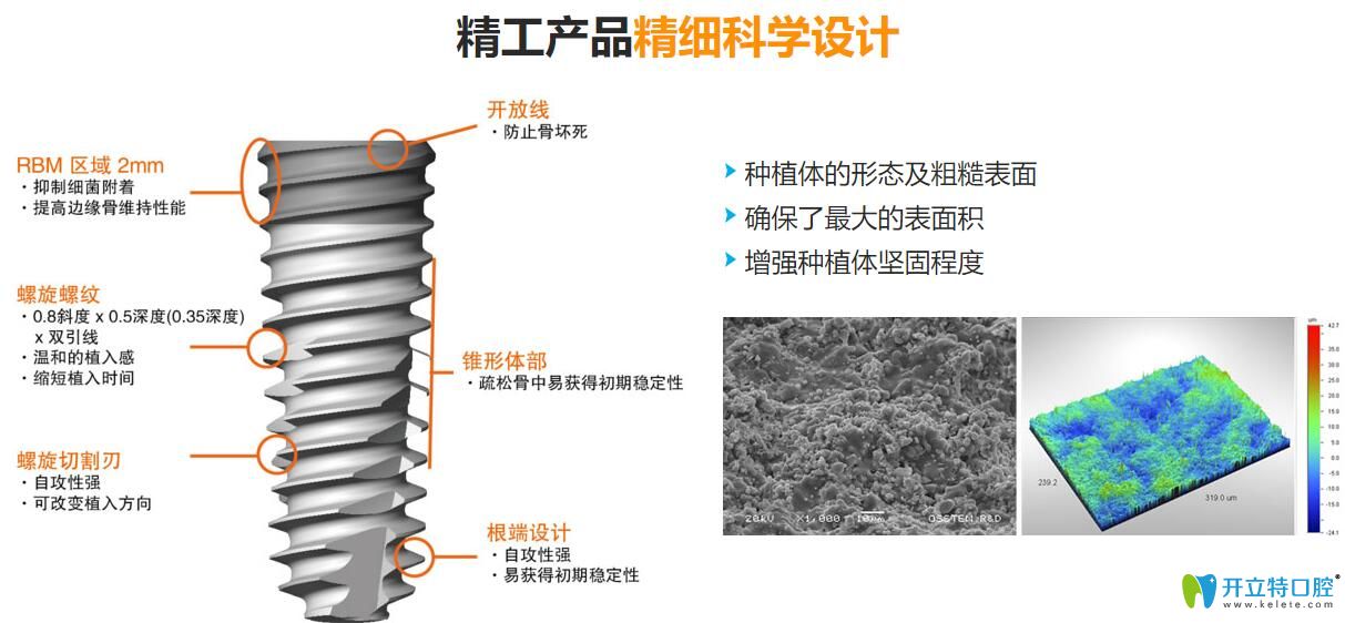 韓國種植牙質(zhì)量怎么樣？韓國種植體價格為什么比較便宜？
