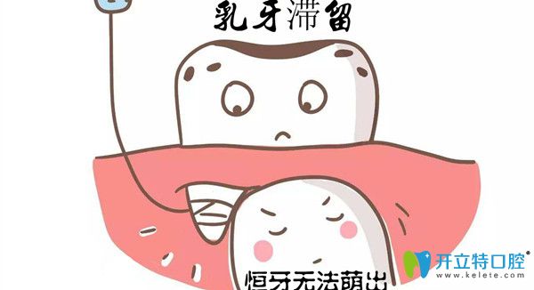 融合牙換牙后會好嗎 融合牙換牙后會好嗎