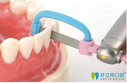 請看：正畸中鄰面去釉對牙齒有危害嗎？