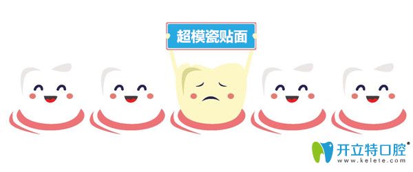 超模瓷貼片好不好？解析超模瓷貼面和全瓷貼面的區(qū)別