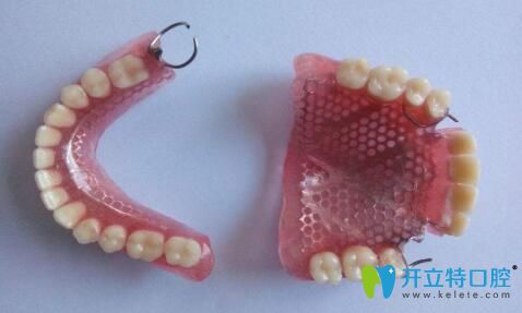 重慶維樂口腔李天游科普：假牙壞了怎么辦