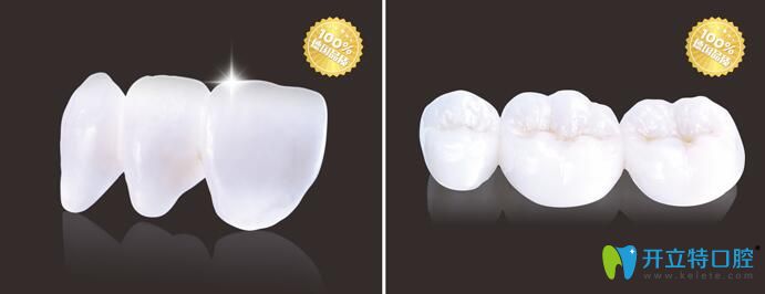 葉一了醫(yī)生特色項(xiàng)目格萊美3D全瓷冠