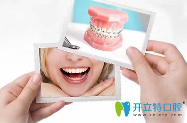 劉慶醫(yī)生科普牙齒矯正為什么會(huì)痛