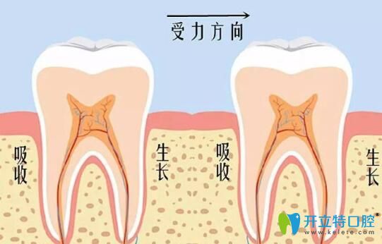 維樂口腔李書琴醫(yī)生告訴你：牙齒矯正會導致牙齒松動嗎