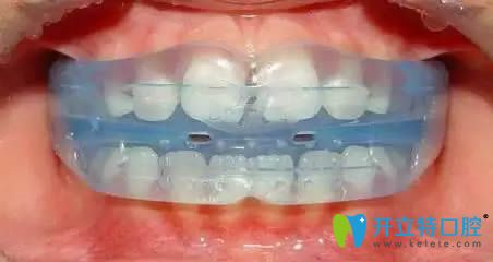 聶歡醫(yī)生談MRC肌功能訓(xùn)練矯治技術(shù)