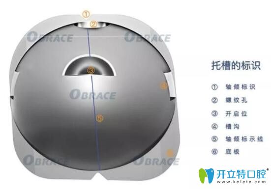 深圳正夫口腔球面自鎖托槽技術(shù)優(yōu)勢