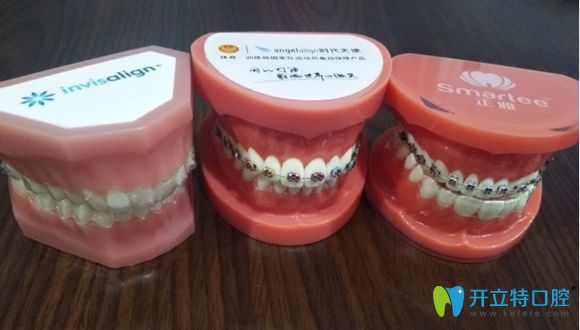 佛山順德壹加壹口腔牙齒矯正技術優(yōu)勢簡介