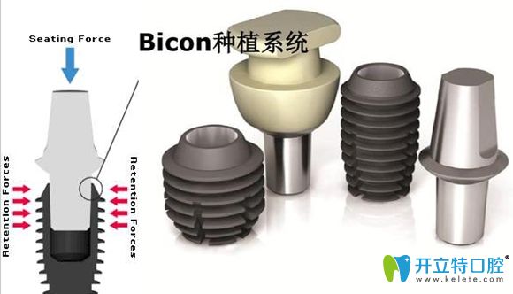 美國(guó)百康種植體及基臺(tái)展示圖