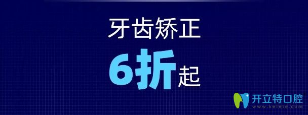 杭州美奧口腔暑期正畸優(yōu)惠活動