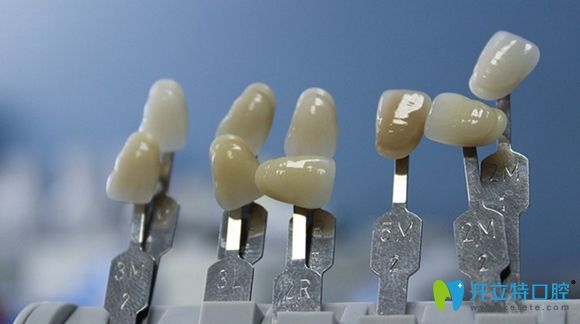 本文匯總了水晶鋯全瓷牙的優(yōu)缺點和價格及使用壽命