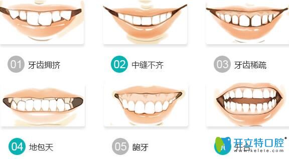 南昌輝煌口腔謝俊醫(yī)生介紹牙齒矯正吃東西禁忌