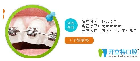 長(zhǎng)沙利爾口腔金屬自鎖托槽矯正需要的時(shí)間