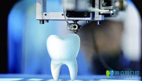 國(guó)內(nèi)數(shù)字化3d打印導(dǎo)板種植牙已上線,種1顆牙僅用10分鐘！