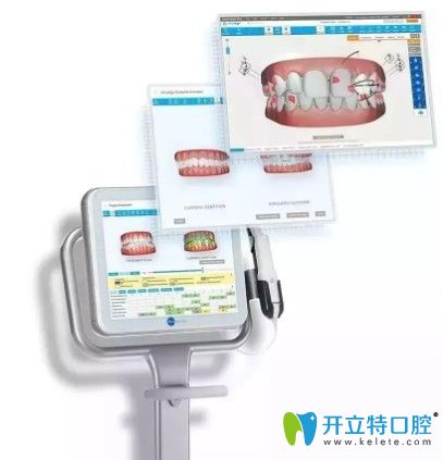 青島維樂口腔iTero口掃