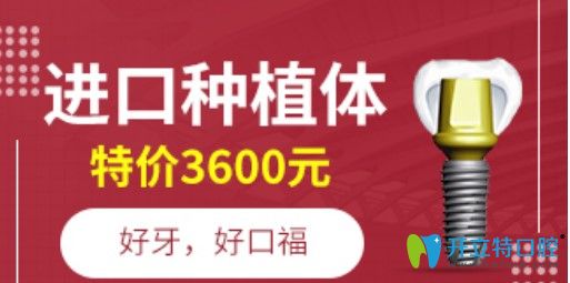 深圳正夫進(jìn)口種植牙優(yōu)惠價(jià)格