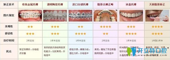 隱形牙套和鋼絲牙套的優(yōu)點(diǎn)宣傳圖