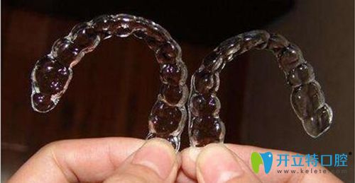 隱形牙套矯治器示意圖