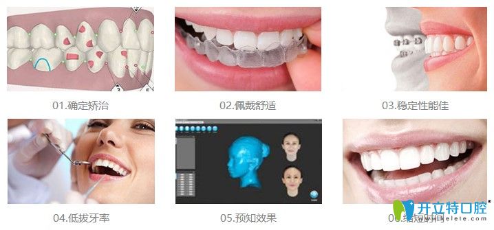 北京維嘉口腔數(shù)字化正畸優(yōu)勢