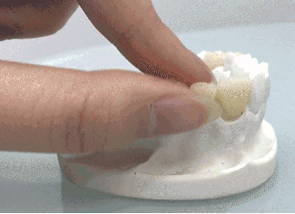 做烤瓷牙疼嗎？網呼千萬不要做烤瓷牙是因為磨牙疼嗎？