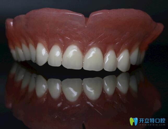 昆明尚愛韓美口腔孫亞杰介紹全口活動(dòng)義齒的優(yōu)缺點(diǎn)