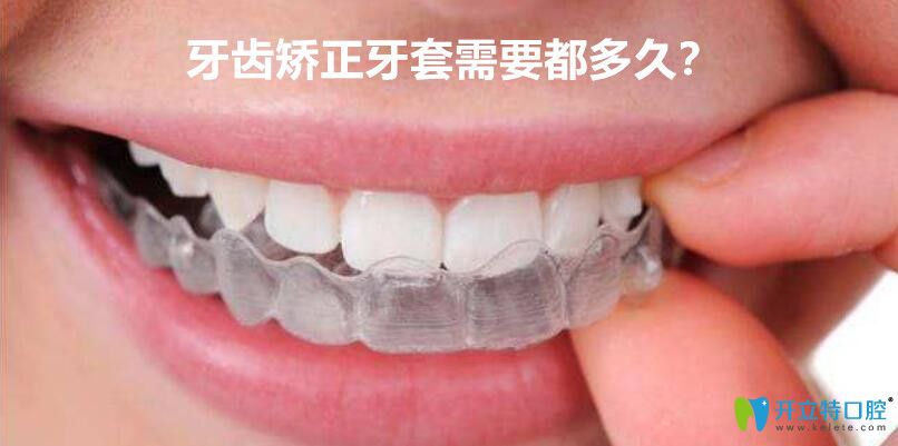 牙套要帶多久？牙齒矯正選擇傳統(tǒng)的牙套好還是隱形的好？