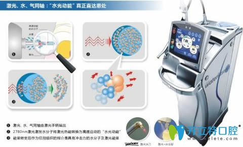水激光口腔治療儀器 水激光口腔治療儀器