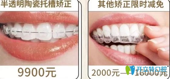 圣貝口腔半隱型矯正和其他矯正優(yōu)惠價(jià)格圖