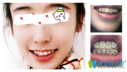 圣貝口腔齙牙矯正<span style=