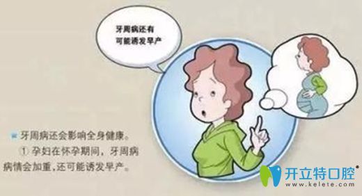 做好孕期口腔保健可預防齲齒