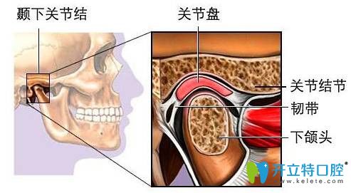 顳下頜關(guān)節(jié)紊亂能整牙嗎？正畸會(huì)不會(huì)導(dǎo)致顳頜關(guān)節(jié)紊亂？
