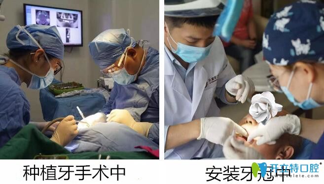 顧客在常州北極星口腔做種植牙手術(shù)中