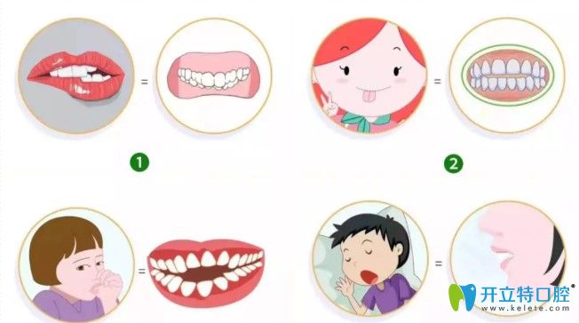 影響頜面發(fā)育的一些舉動(dòng)圖示