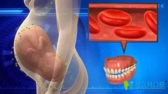 孕期牙疼需要及時到醫(yī)院看診