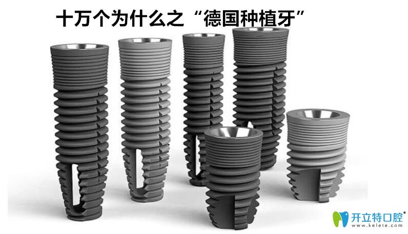 德國(guó)種植牙品牌及價(jià)格是多少?看完再說(shuō)德國(guó)植體什么牌子好