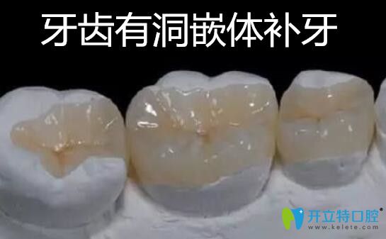 牙齒有洞嵌體補(bǔ)牙